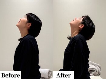 ソレア(Solea)/肩こり・反り腰改善1回目