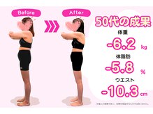 豊田まえやま接骨院/５０代のダイエット　横向き