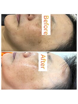 ヴィノス(VINOS)/お肌のトーンも上がります♪