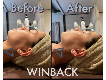 シストワ(sistoi)/★☆★WINBACK★☆★