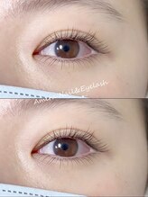 アミーラ(Amira)/フラットラッシュ上+下