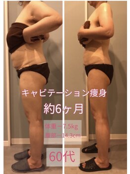 サロン ド フェイス モアナ(Salon de Faith Moana)/キャビテーション痩身【60代】