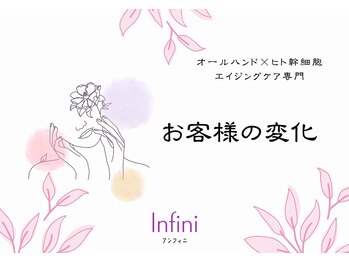 アンフィニ 麻布十番(Infini)/＠オールハンド×ヒト幹細胞