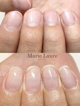 マリーロール 梅田店(Marie Laure)/自爪育成/深爪矯正/ネイルケア