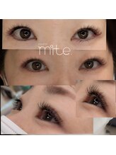 ミテ(mite.)/150本イメージ