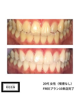 レオン 磐田(REON)/◇ お客様 before＆after ◇
