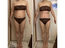 ヴェリティー(Verity)/ビフォーアフター