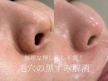 ラシュール(Rassure)/毛穴レスなお肌へ/ビオフィート