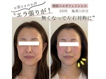サロンニコ(salon Nico)の雰囲気（エラ張り/二重顎/食いしばり/左右非対称/小顔/ヘッドスパ/毛穴）