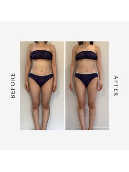 ラグレ(LUXRE)/次世代EMS効果（30代）