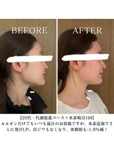 ヨサパーク ココロネ 大倉山(YOSA PARK kokorone)/水素吸入で効果UP! 浮腫/美白