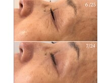 エービューティーサロン 松山店(A BEAUTY SALON.)