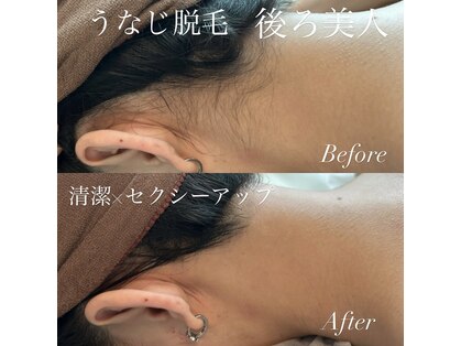レア(le`a)の写真