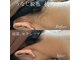 レア(le`a)の写真