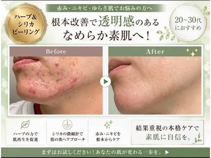 レヴェイユ(Reveil)の写真