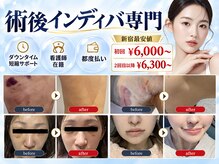 術後インディバ専門サロン 新宿