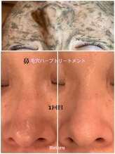 ナチュール(NaTuRu)/毛穴ハーブトリートメント1回1g