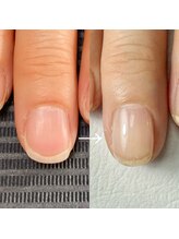 ジル(JiLL)/【自爪育成】