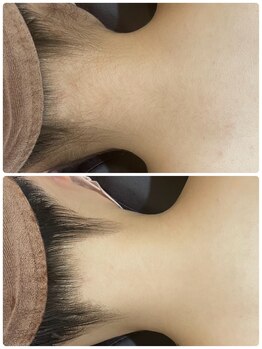 エステティック レイビス 銀座店(RAYVIS)/IPL脱毛