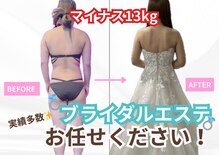 インプルーブ エステティック(Improve ESTHETIC)