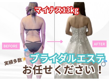 インプルーブ エステティック(Improve ESTHETIC)の写真