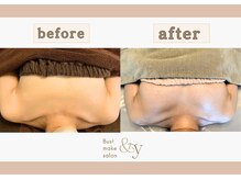 アンド ワイ(&y)/20代／出産歴なし