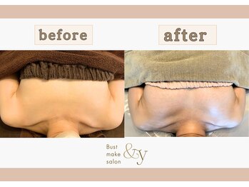 アンド ワイ(&y)/20代／出産歴なし