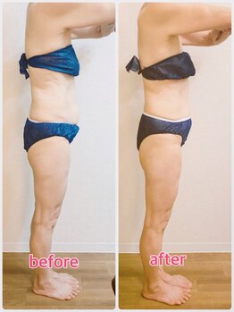 リナル 武蔵小杉店/120分☆痩身マシン+全身リンパ