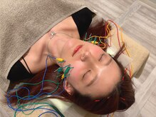 四条大宮アシスト鍼灸整骨院/美容鍼（電流あり）