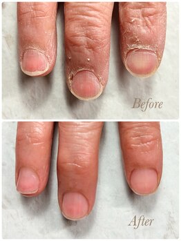 ソワン(soin)/Before→After