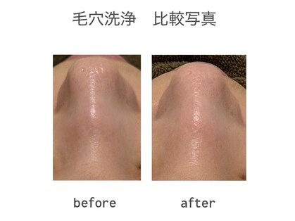 エステサロンひかりの写真