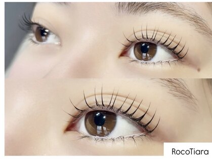 ロコティアラ(Roco Tiara)の写真