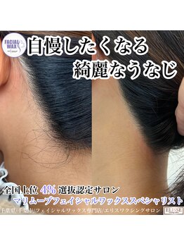 エリス(ELISSE)/うなじ脱毛