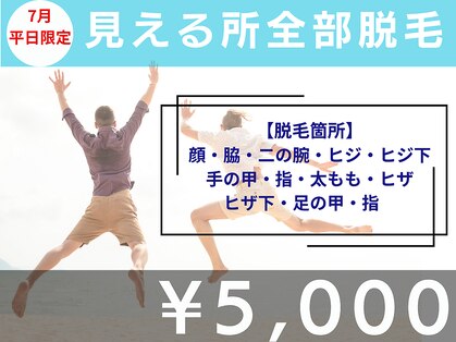 ユー(U)の写真