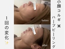 サロンワイアネシス(Salon y ANESIS)の雰囲気（小顔コルギ1回の変化/名古屋コルギ/久屋大通コルギ/小顔リンパ）