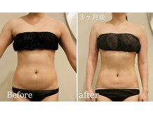 お客様の結果【Before】【after】