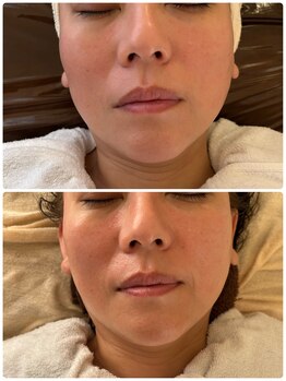 ナナプラス(nana plus)/乾燥ケア