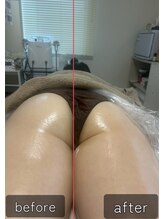 エメカシワ(Aimer KASHIWA)/1回での変化