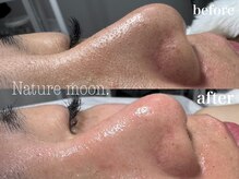 ナチュールムーン(Nature moon.)/毛穴洗浄