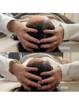 アウラ(Aula)/睡眠の質が高まる