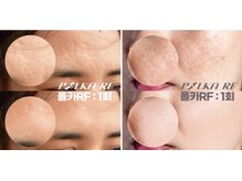 マリーメリー(marie merry)/マシュマロリフト