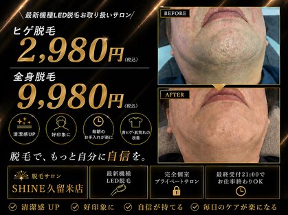 シャイン(SHINE)の写真