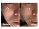 インディバサロン ド メイリィチィフゥア(indibasalon de meiliqihua)の写真
