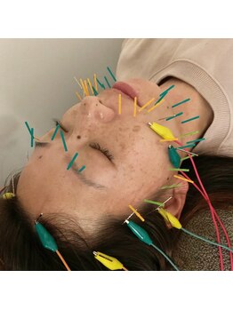 久留米鍼灸整体サロン/