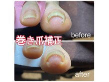 パスリー ネイルアンドケア(Parsley Nail&Care)の雰囲気（巻き爪補正はジェルやマニキュアと合わせることも出来ます♪）