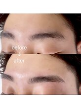 アイズ(EYES)/ハリウッドブロウリフト