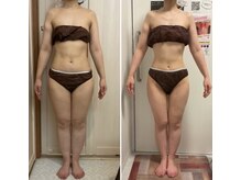 ヴェリティー(Verity)/ビフォーアフター