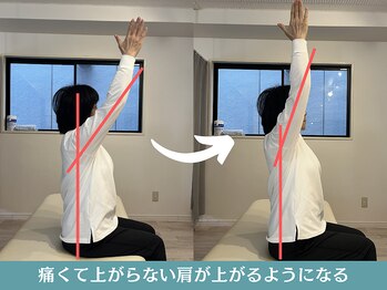 ピーボディ 神戸三宮院(P-body)/辛い肩の痛みはお任せください!