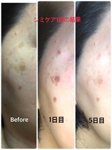 オルオル(olu olu)/