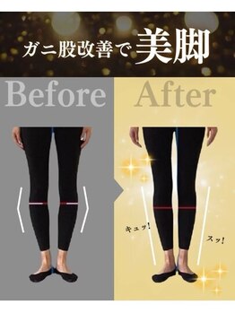 デップ 山梨昭和町店Act.(DEP)/【山梨ピラティス】O脚・膝痛